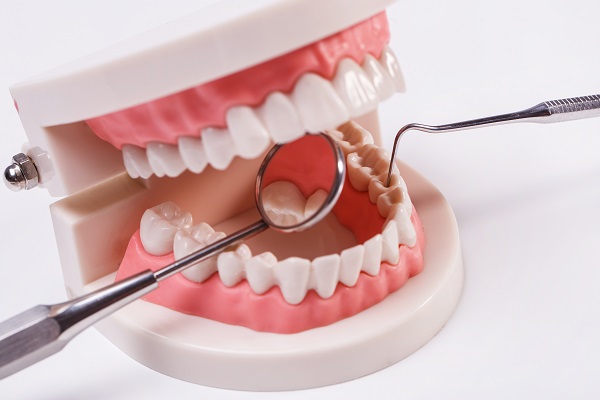 Is root canal therapy a permanent option for infected teeth?